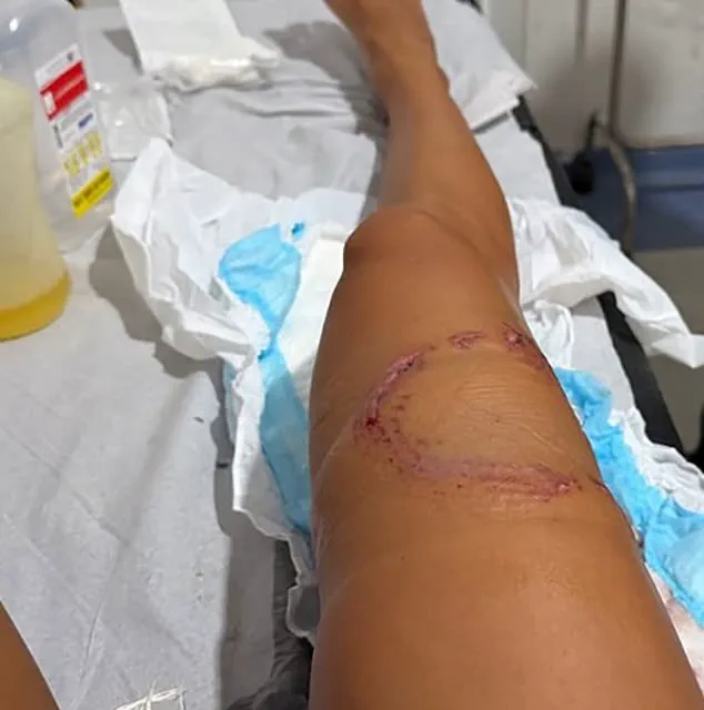 Harrowing Shark Encounter in Brazil's UNESCO Site Underlines Risks to Ecotourism