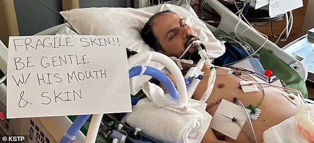 Libyan Immigrant with Rare Skin Condition Faces Deportation to Libya, Family Warns of 'Death Sentence'